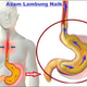 Illustration for article titled Obat Asam Lambung Naik Alamiem/em